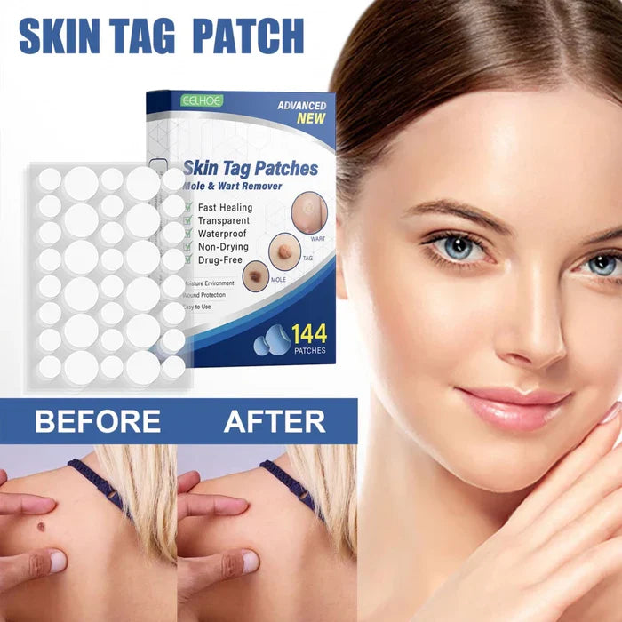 Tag Removal Patch (Pack of 72 pcs)