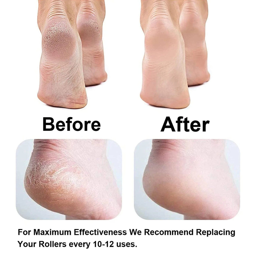 Electric Callus Remover | Callus Remover Foot Treatment  Cleaning Electric Callus Pads - Electric Callus Remover