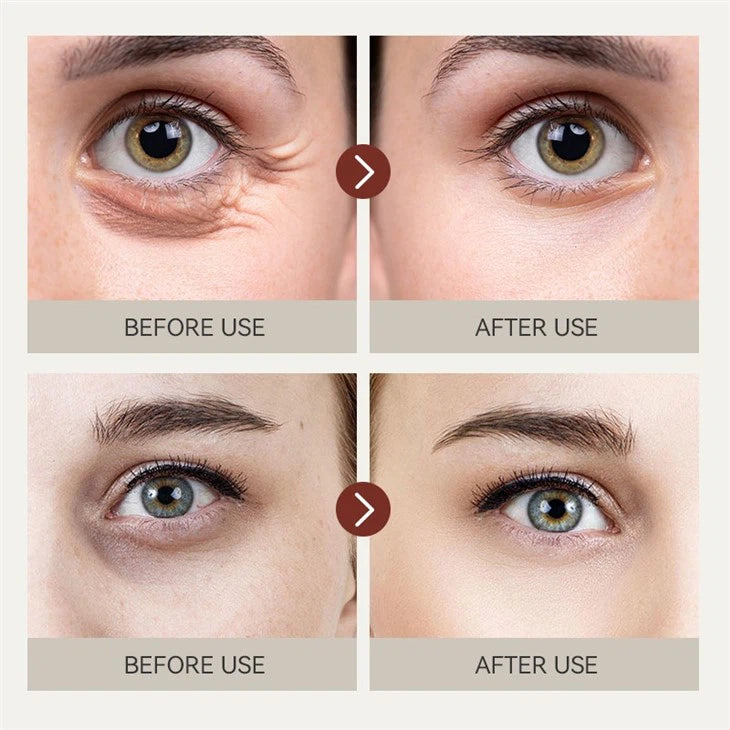 IREV Retinol Eye Cream (Pack of 2)