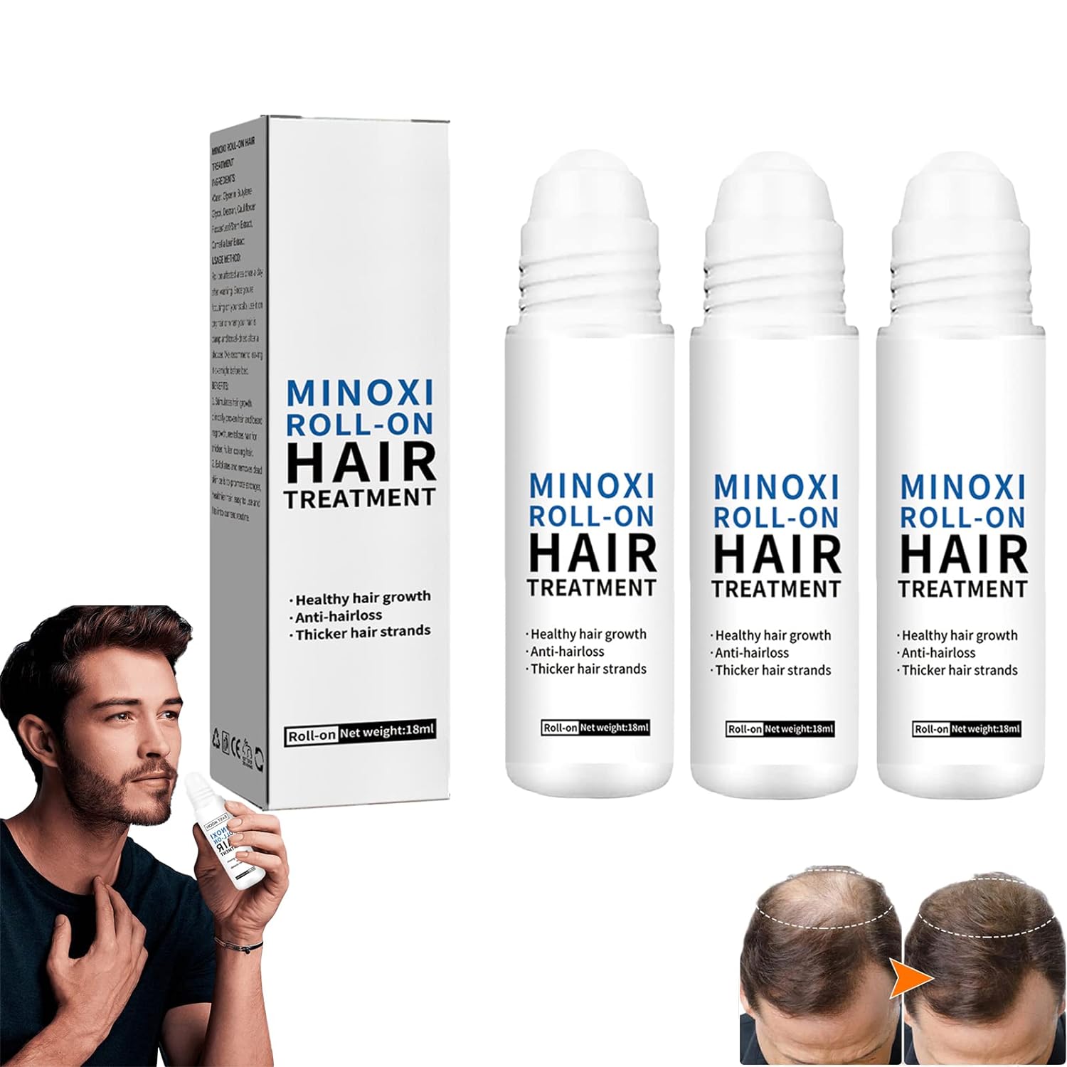 Minoxi Roll-On Hair Treatment (Pack of 2) Zaavio®