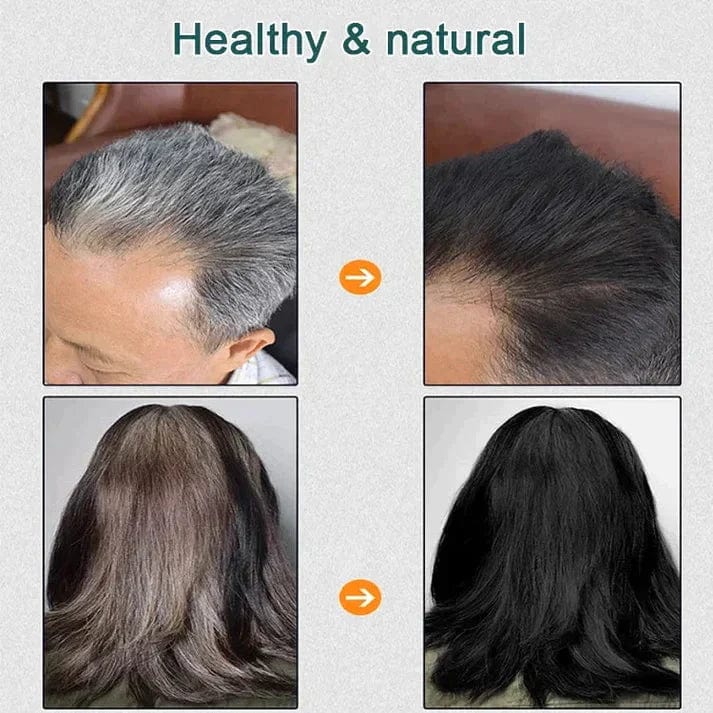 Natural Plant Hair Dye 🔥BUY 1 GET 1 FREE🔥 Zaavio®