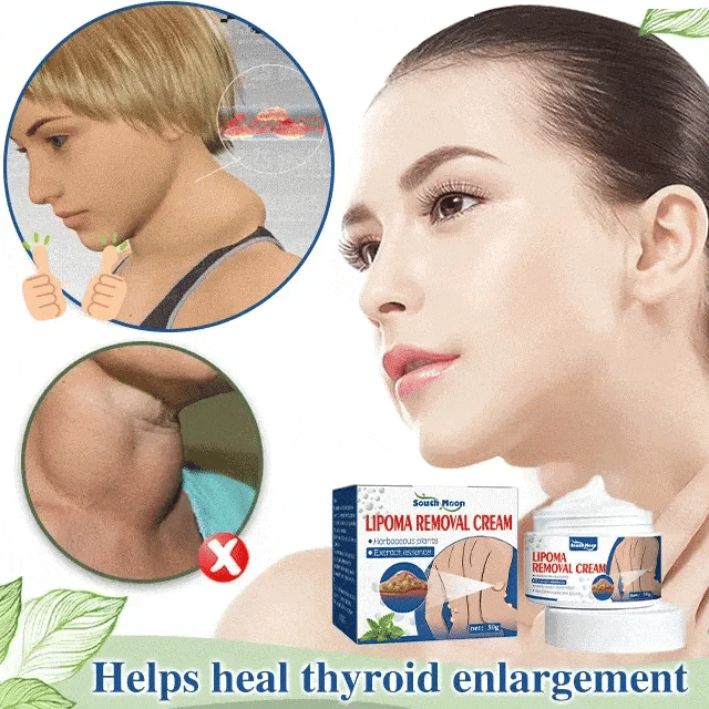 Removel Cream Herbal Lipoma Removal Cream WowSmart