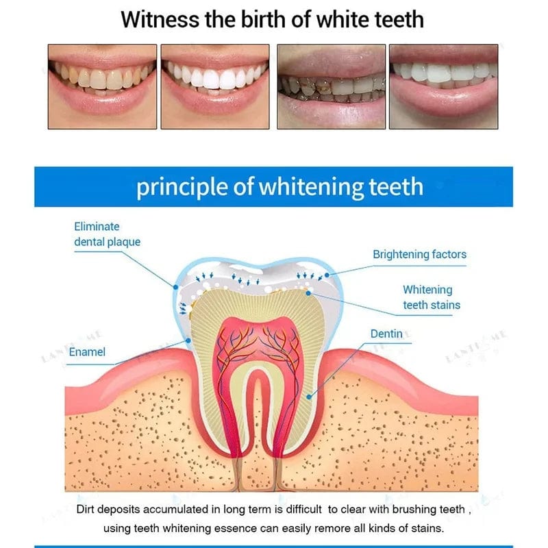 Teeth Whitening Pen Marker Whitening Products Instant Gel Treatment - Dentipen™️ Dentipen™️ Zaavio®