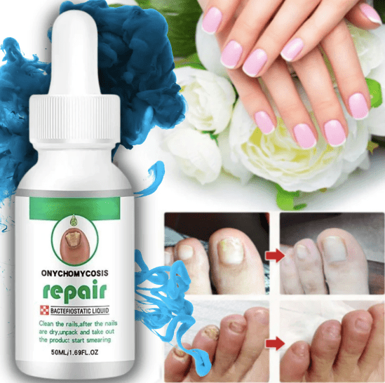 Big Bottle Nail Serum For Complete Nail Protection, Long healthy & fungus free nails Zaavio®