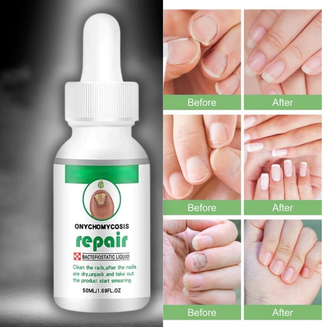 Nail Serum For Complete Nail Protection, Long healthy & fungus free nails Zaavio®