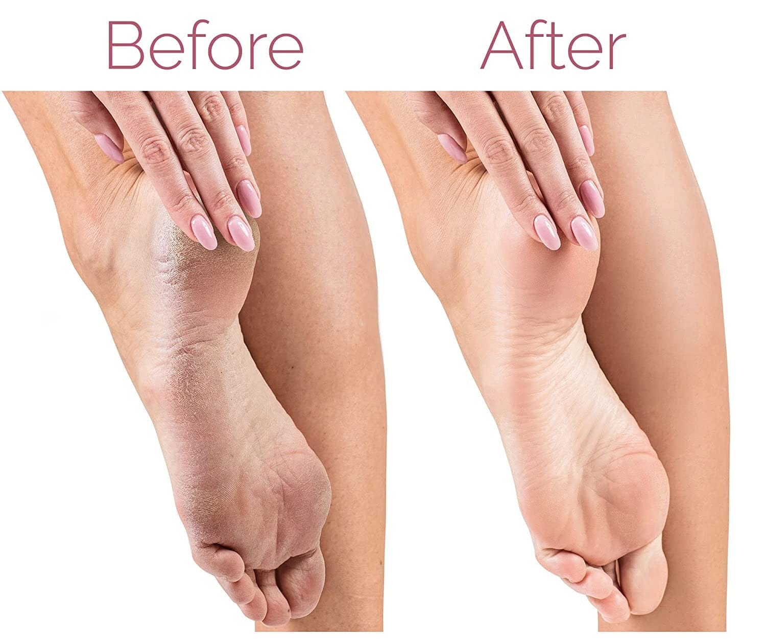 Rechargeable Callus & Dead Skin Remover Fab Alchemy