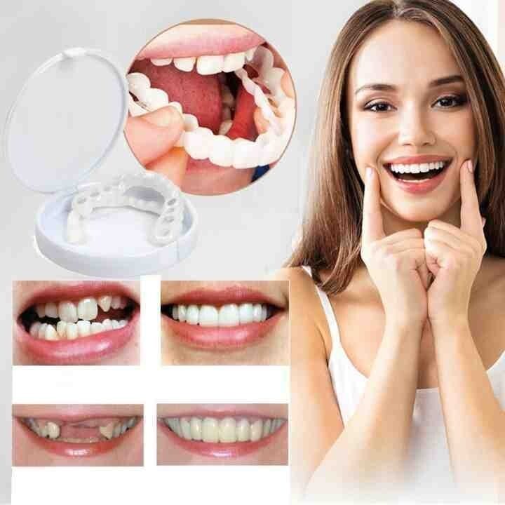 White Teeth Braces Clip On Veneer Teeth Perfect Dental Braces - Ezysmyl™️