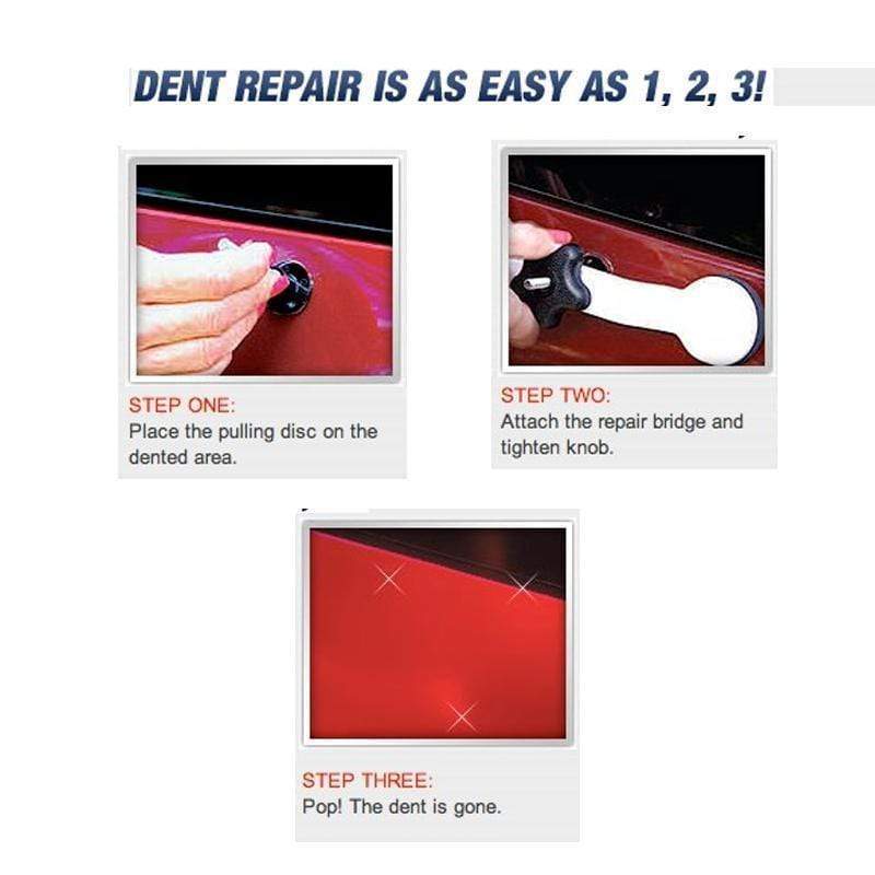 Car Dent Remover Paintless Removal Dent Repair Kit - Undenter™