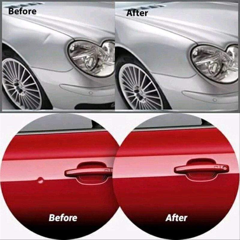 Car Dent Remover Paintless Removal Dent Repair Kit - Undenter™