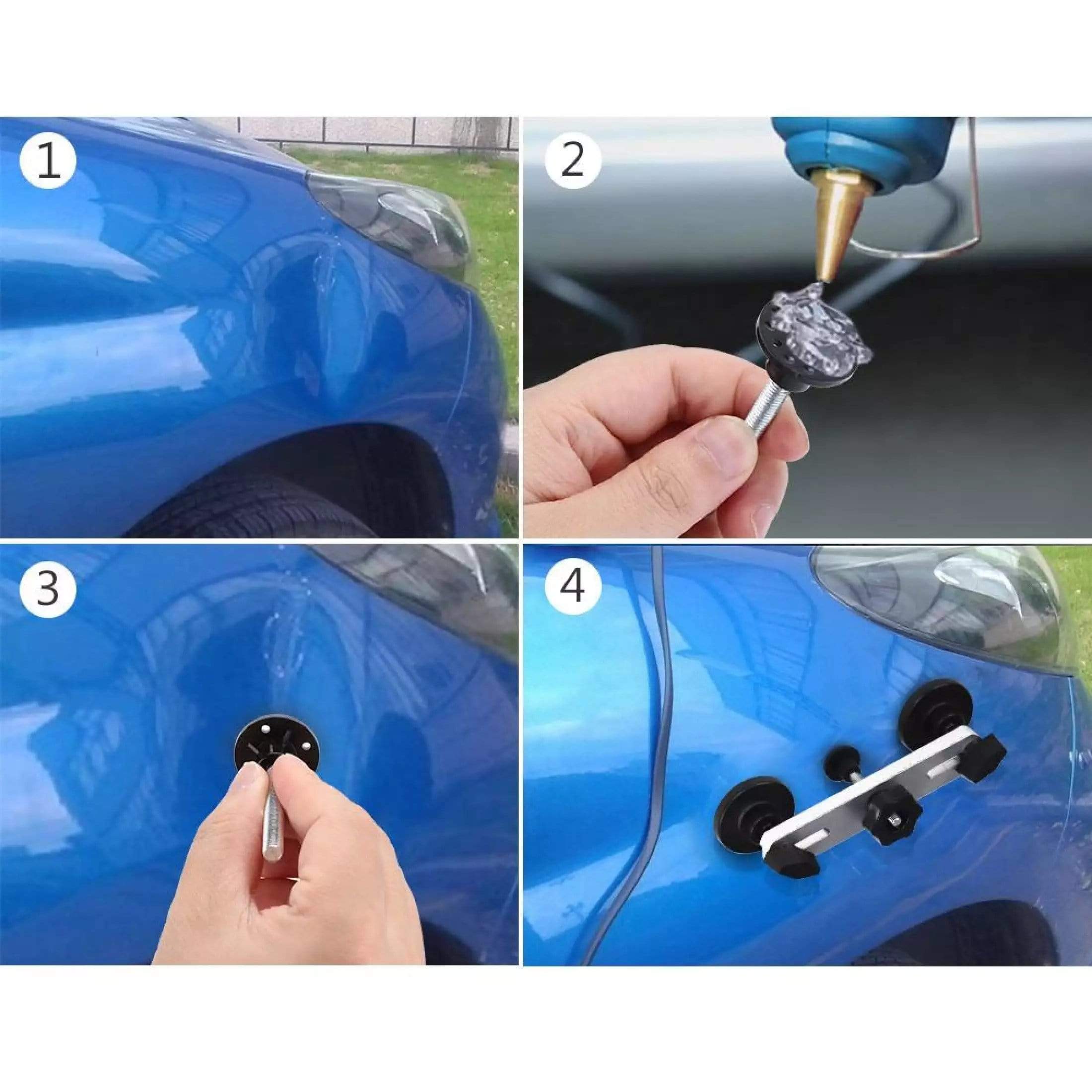 Car Dent Remover Paintless Removal Dent Repair Kit - Undenter™