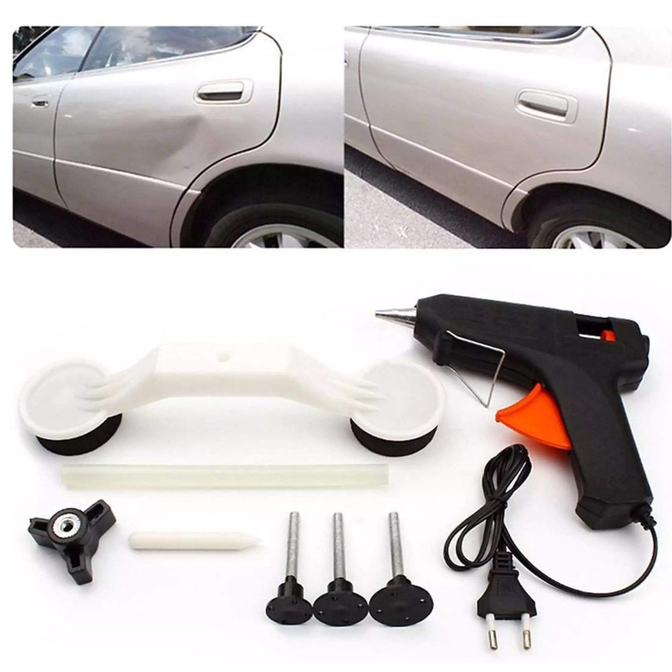 Car Dent Remover Paintless Removal Dent Repair Kit - Undenter™